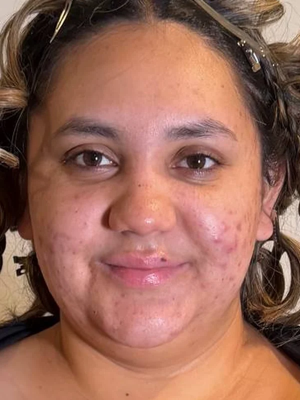 Before: no makeup